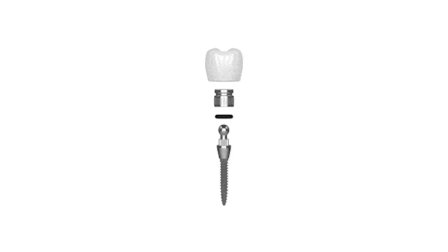 Mini Implantes Dentales en Austin TX Dr. Brandon Hall Aspire Dental