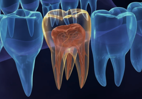 Endodoncia en Austin TX Dr. Brandon Hall Aspire Dental