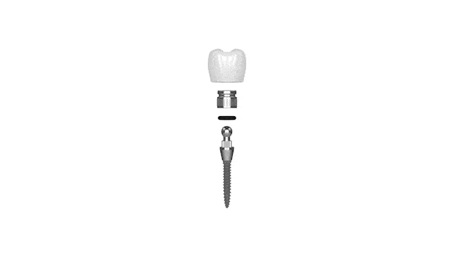 Mini Dental Implants in Austin TX Dr. Brandon Hall Aspire Dental