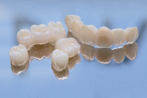 Crowns and Bridges in Austin, TX Aspire Dental